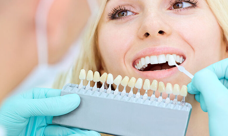 How to Prepare for Your Cosmetic Dentistry Procedure?