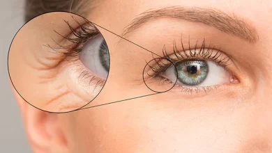 Understanding The Causes Of Under Eye Wrinkles And How To Prevent